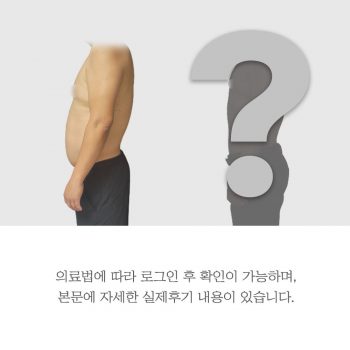 [체질개선] 2개월간 -17.5kg 감량성공